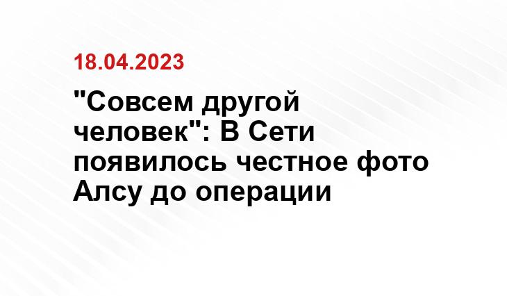 "Совсем другой человек": В Сети появилось честное фото Алсу до операции