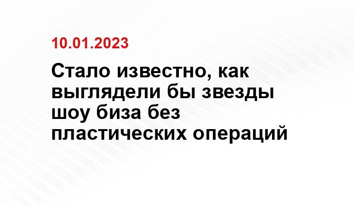 Стало известно, как выглядели бы звезды шоу биза без пластических операций