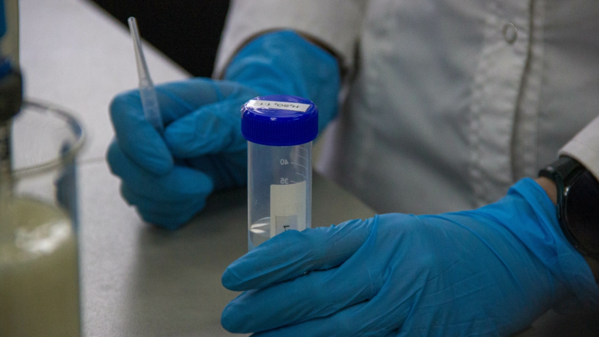 Нипах vs COVID: отличия, последствия. Новый вирус начинается с боли в горле – 75% летальность, кома ИА SM-News